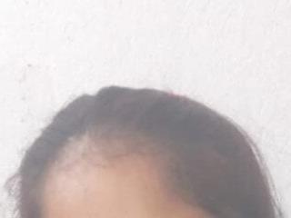 Anchal-si