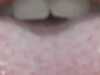 Atrevidallf1