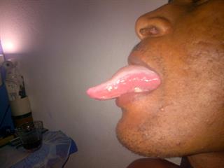 calme odl1