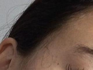 EadlinBarren