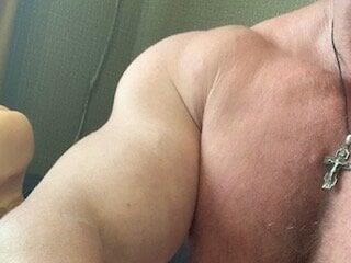 FISTCAMM