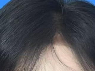 Q mini