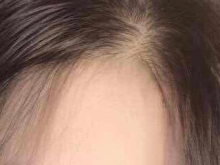 Tnhuy1