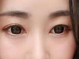 xiuchun100